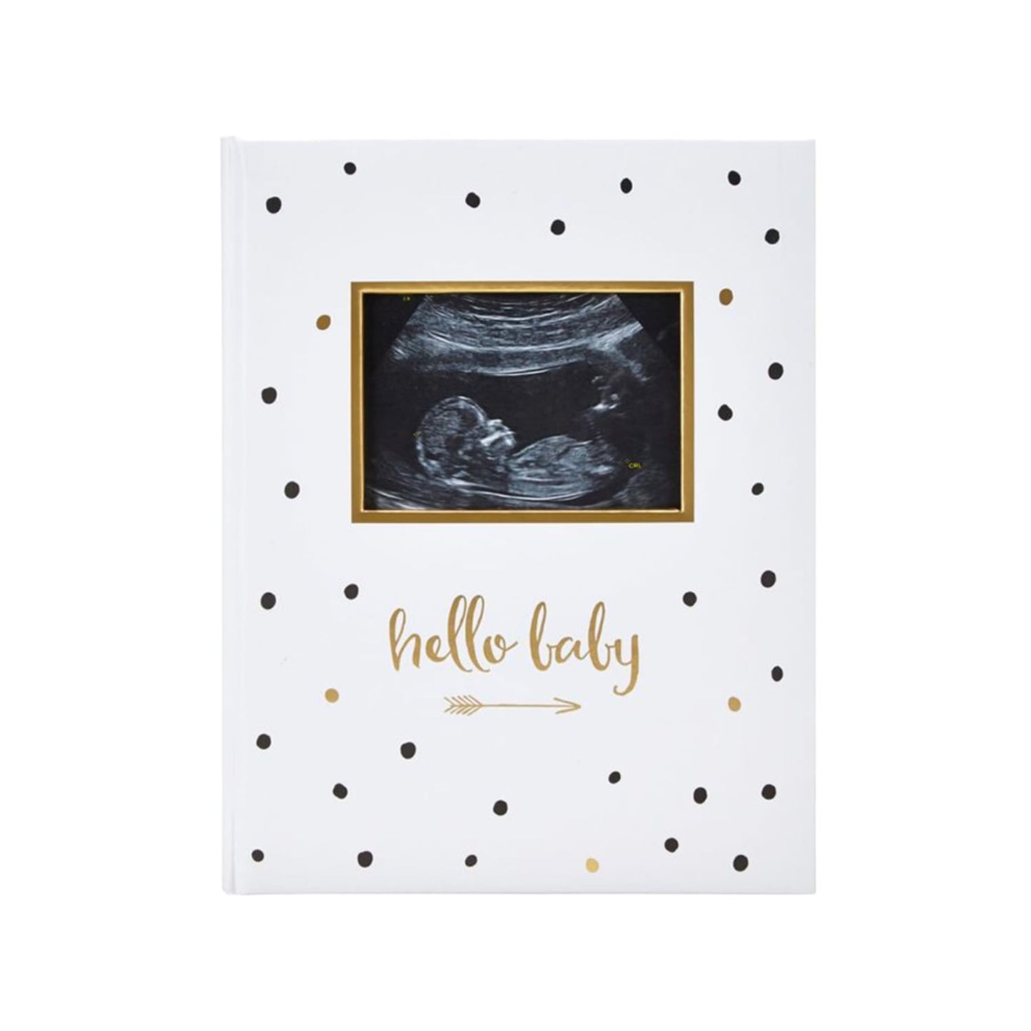 Pearhead Hello Baby First 5 Years Memory Book, Gender-Neutral Baby Keepsake for New and Expectant Parents, Pregnancy And Milesto