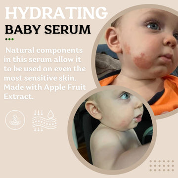 Roe Wellness- Baby Serum Skincare Probiotic Protection | Hydrating, Soothing, Clean Ingredients & Safe For All Skin Babies, Infa