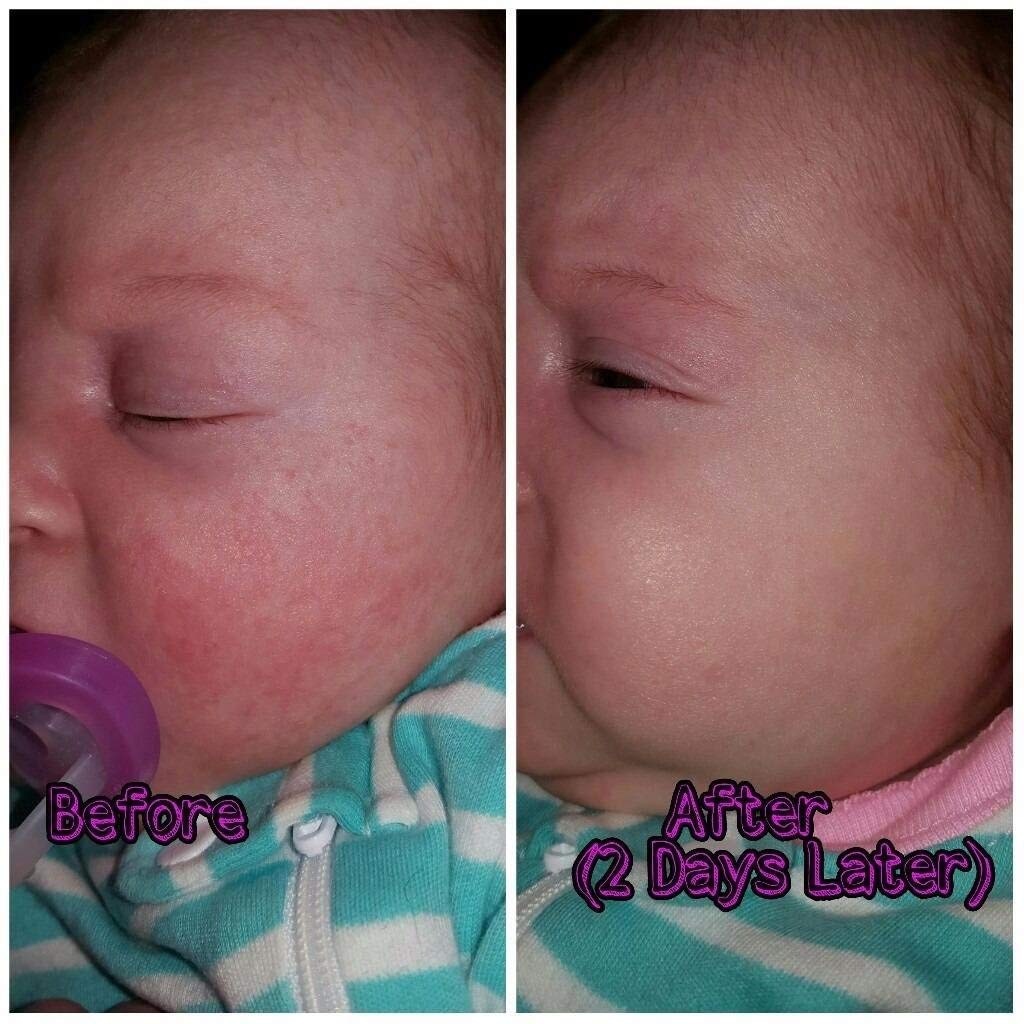 Babybiotics - Topical Probiotic Body Care For Children Of All Ages 4Oz -Hypoallergenic, Vegan, Non Gmo, Gf, 100% Natural Live Pr