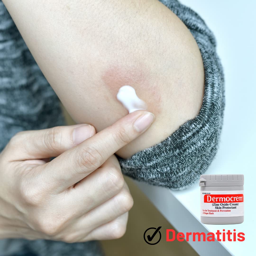 Dermocrem 2.1 Oz (60 Gr) Diaper Rash Cream For Baby, Soothes, Heals, And Protects, Relief And Treatment Of Diaper Rash, Zinc Oxi