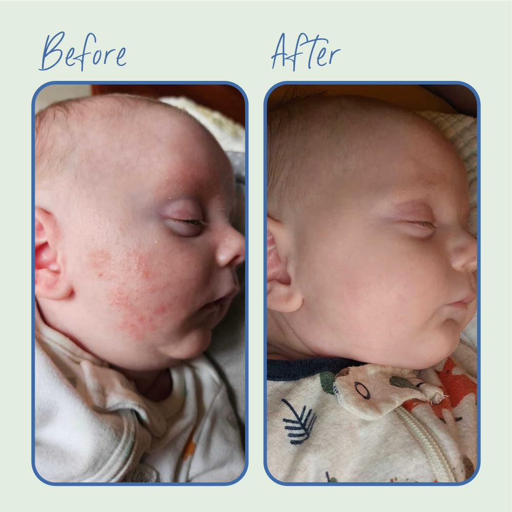 Tubby Todd All Over Ointment For Babies, Multi-Purpose Baby Eczema Cream For Sensitive Skin, Dry Skin, Rash, Irritation - 2 Pack