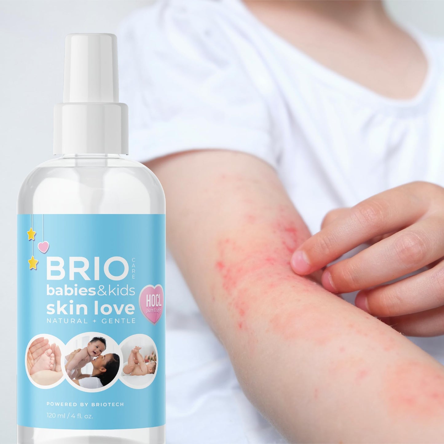 Briotech Babies & Kids Skin Love, Soothing Hypochlorous Acid Spray, Pure Hocl For Sensitive Skin, Calm Redness & Bumps, Support
