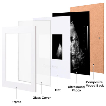 Eletecpro Ultrasound Picture Frame With Real Glass Cover And 3 Different Mats, 7X7 Baby Keepsake Frame For 3X4 Inches Sonogram P