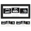 Sonogram Picture Frame - Trio Ultrasound Picture Frames For Mom To Be Gift - Baby Ultrasound Frame - Pregnancy Announcements Son