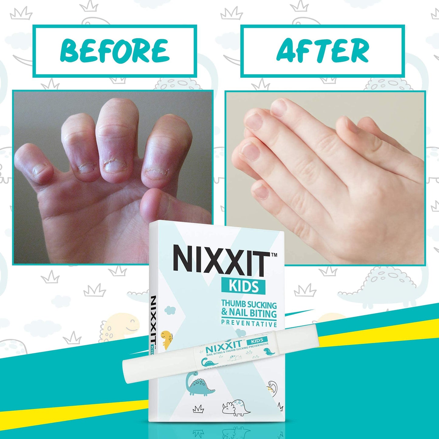 Nixxit Nail Biting Treatment For Kids - Stop Thumb Sucking For Kids, Toddlers, Children - No Bite Nail Polish Pen - Non Glossy -