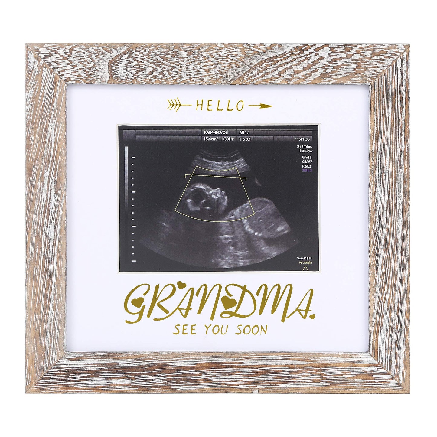 Iheipye Grandma Sonogram Picture Frame - Baby Announcement Gifts Grandparents Frame - Grandma Pregnancy Announcement Gift, Soon