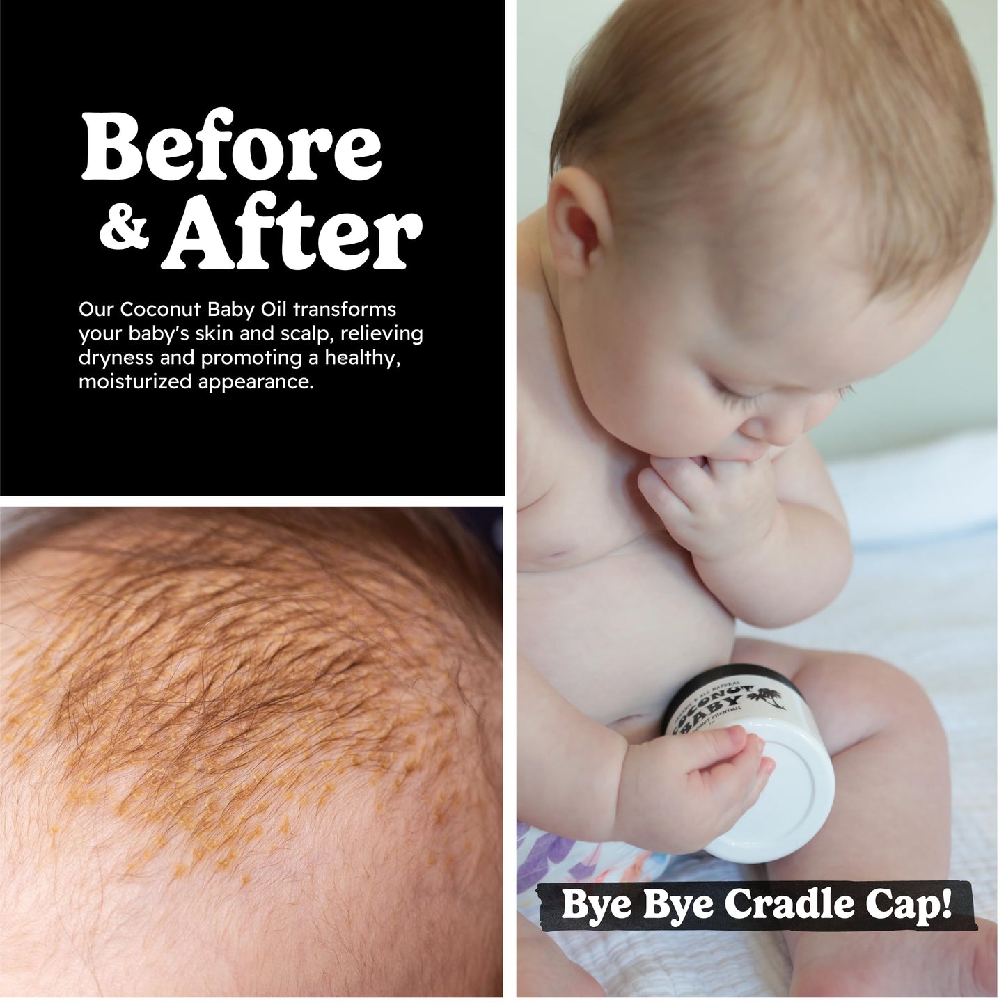 Coconut Essentials Coconut Baby Oil, Natural & Organic Moisturizer For Newborn Sensitive Skin, Eczema & Psoriasis Relief, Hair O