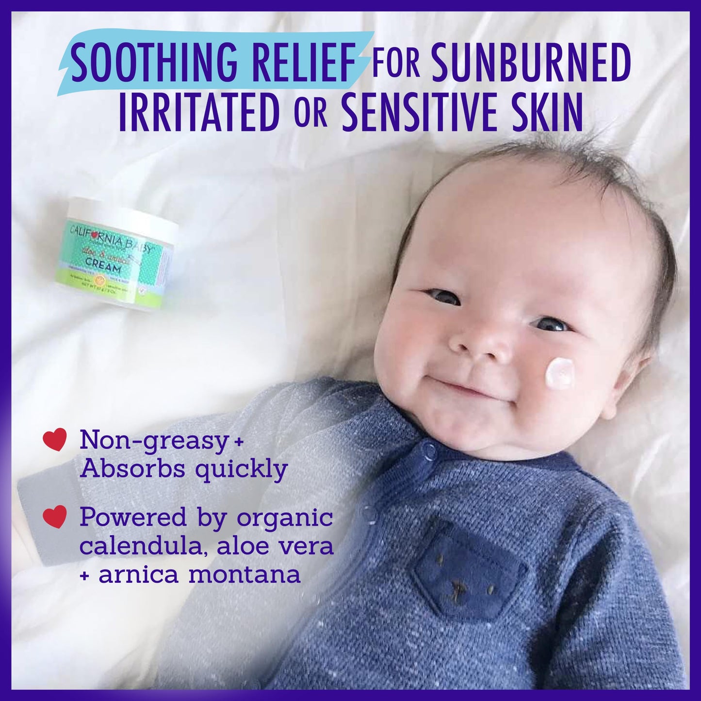 California Baby Aloe & Arnica Cream | Soothing Sunburn Relief Cream | Moisturizes Dry, Irritated Skin | 100% Plant-Based After S