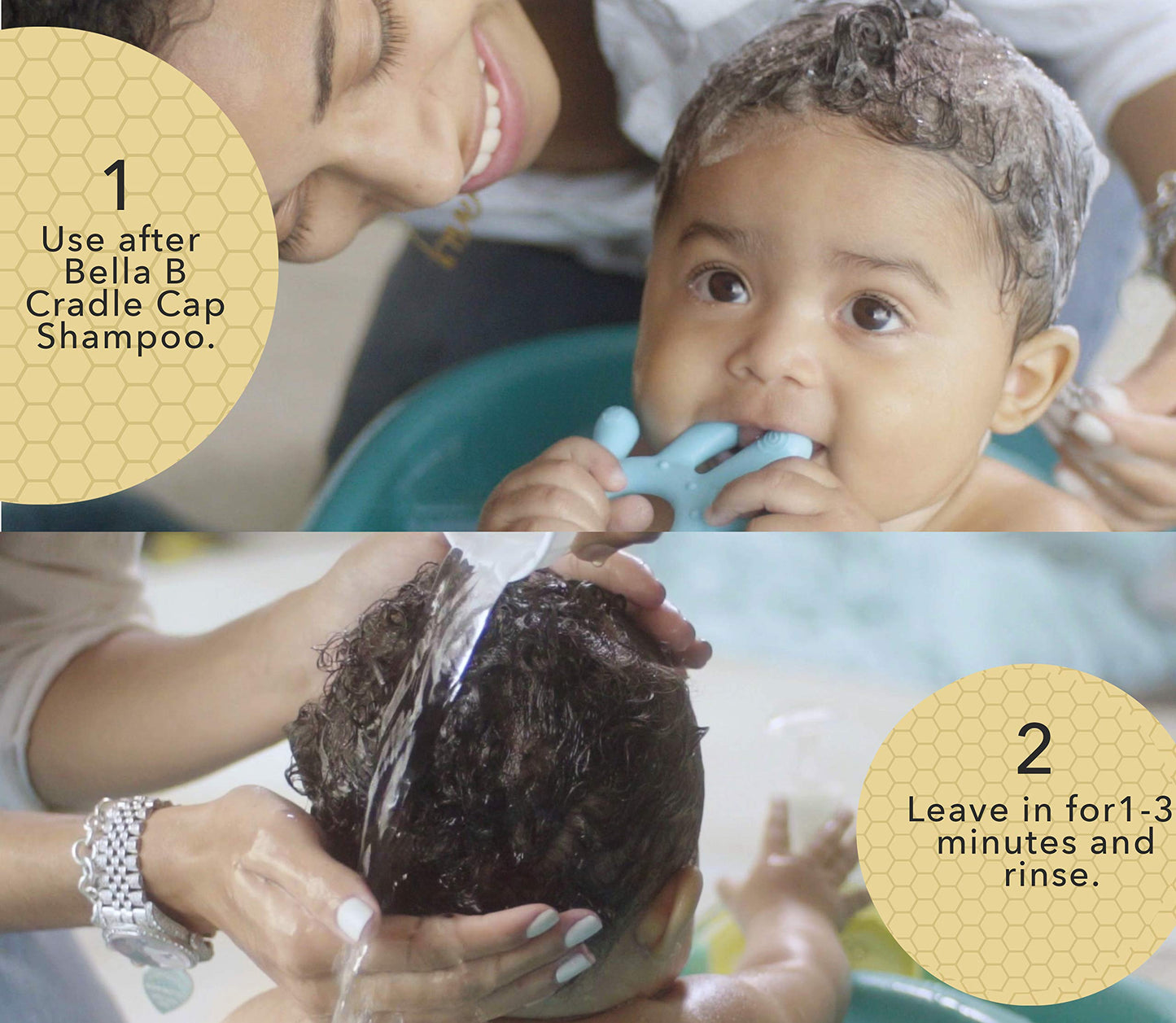 Bella B Healthy Hair & Scalp Baby Cradle Cap Treatment 8 Oz - Cradle Cap Treatment For Babies - Baby Conditioner Silky Hair Care