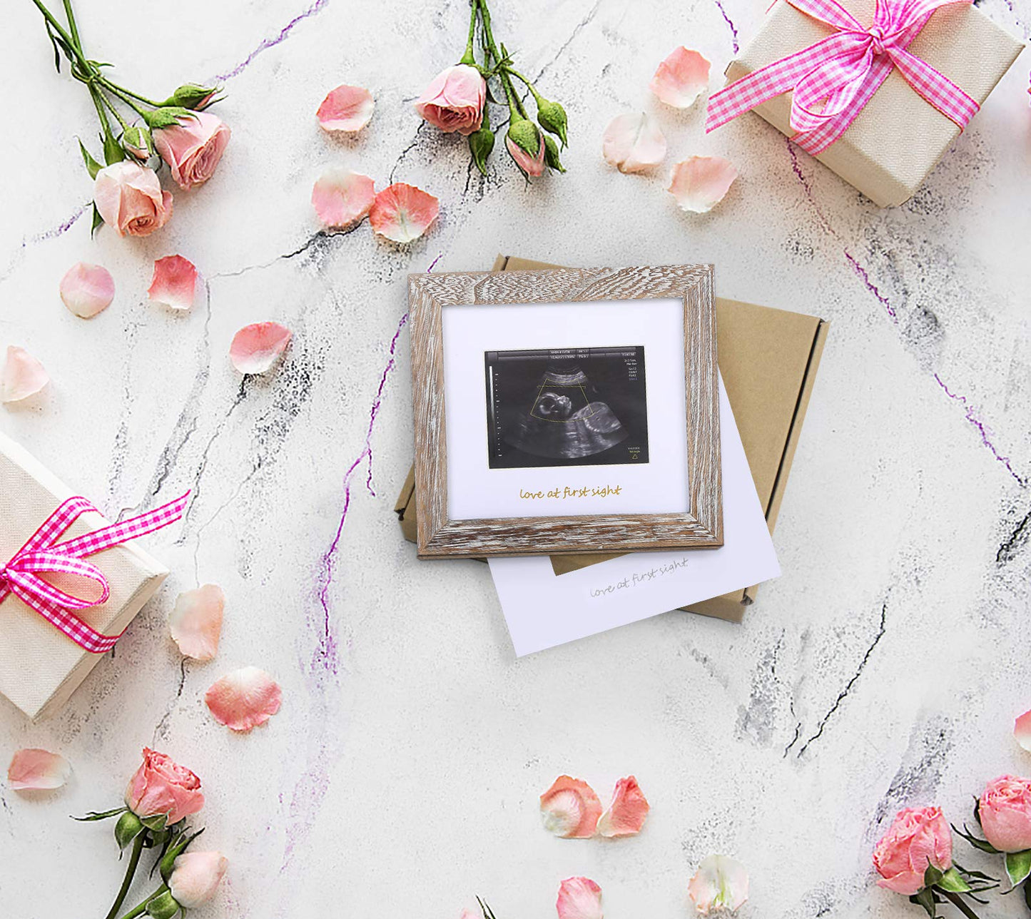 Iheipye Baby Love At First Sight Sonogram Keepsake Frame - Ultrasound Picture Frame - Pregnancy Announcement Frame For Expecting