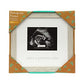 Kate & Milo Rustic Sonogram Baby Keepsake Photo Frame, Spanish Baby Ultrasound Frame, Amor A Primera Vista New Baby Keepsake Fra