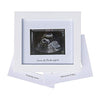 Iheipye Baby Sonogram Photo Frame - 1St Ultrasound Picture Frame - Idea Gift For Expecting Parents,Baby Shower, Gender Reveal Pa