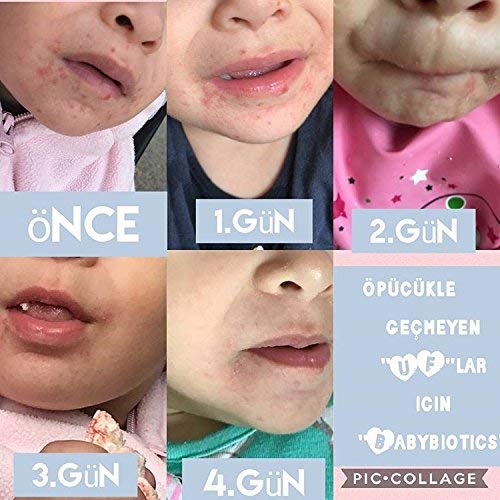 Babybiotics - Topical Probiotic Body Care For Children Of All Ages 4Oz -Hypoallergenic, Vegan, Non Gmo, Gf, 100% Natural Live Pr