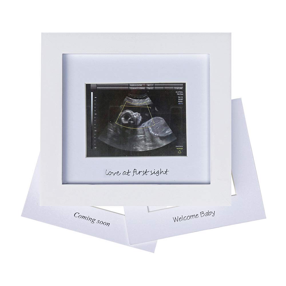 IHEIPYE Baby Sonogram Photo Frame Ultrasound Picture Frame White