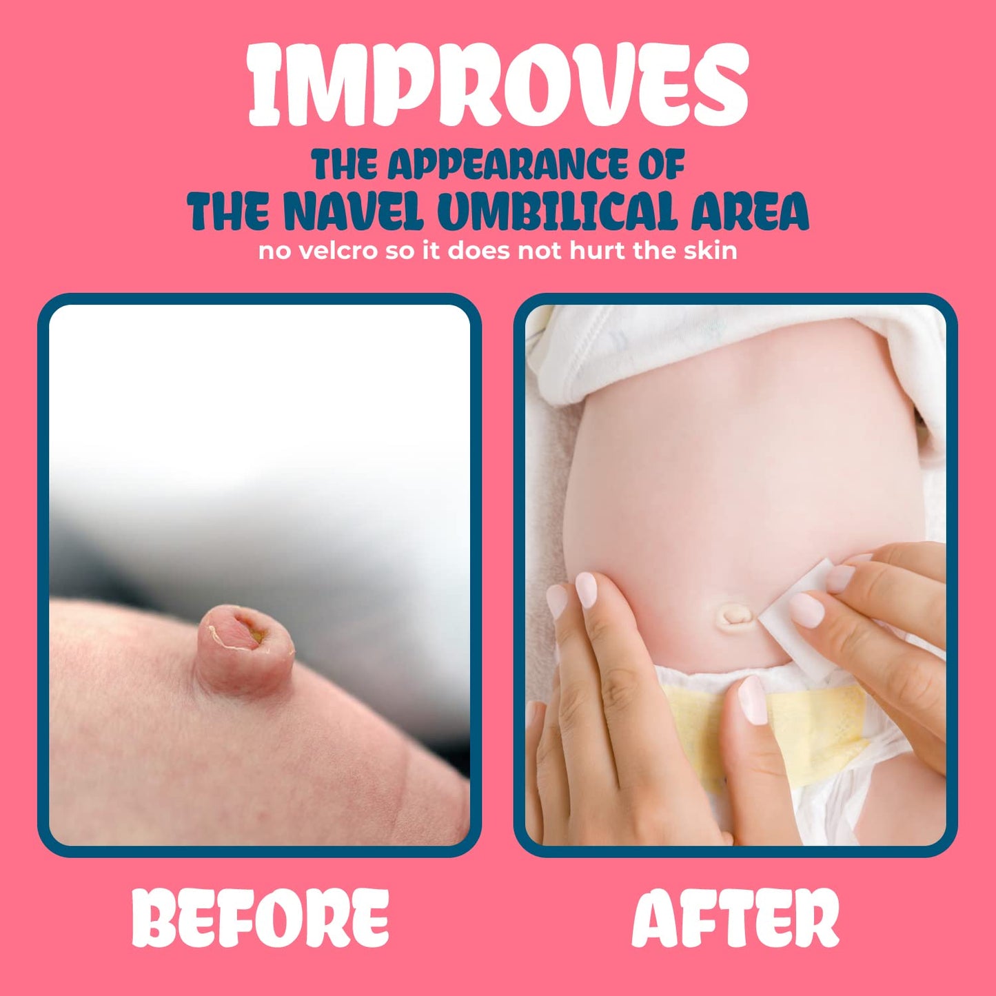 Baby Belly Button Shaper Plug - Baby Belly Band - Hernia Belt - Baby Belly Button Band - Umbilical Hernia Belt Baby - Baby Stoma