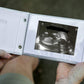 Pregnancy/Maternity Ultrasound And Photo Album/Keepsake