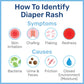 Penaten Medicated Creamy Diaper Rash Treatment, 113G