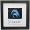 Hamuiers Love At First Sight Ultrasound Picture Frames, Sonogram Picture Frame, Pregnancy Announcement For Grandparents, Baby An