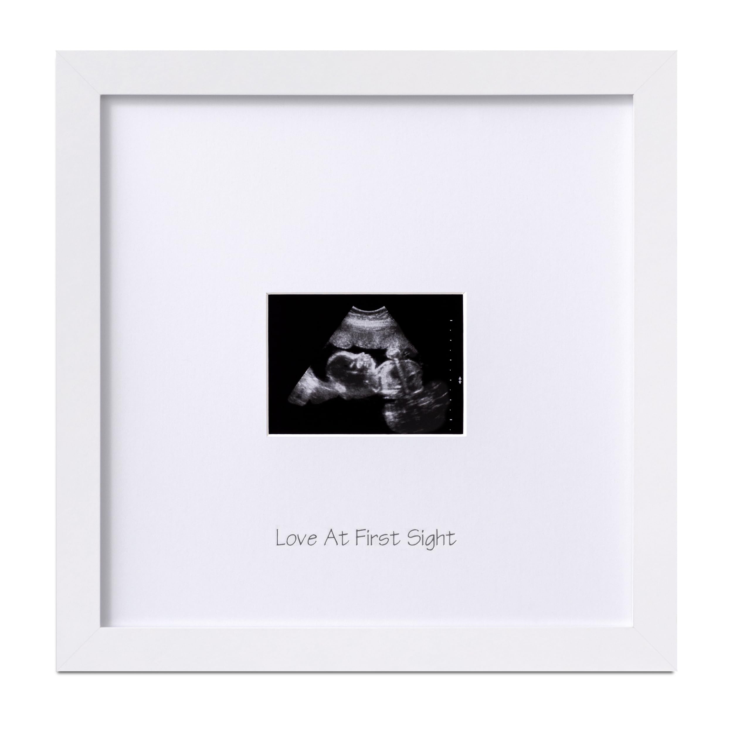 Eletecpro Baby Sonogram Picture Frame, Display 3 4 Ultrasound Photo, K – Cutebab WBCBBB0C8D1DF89