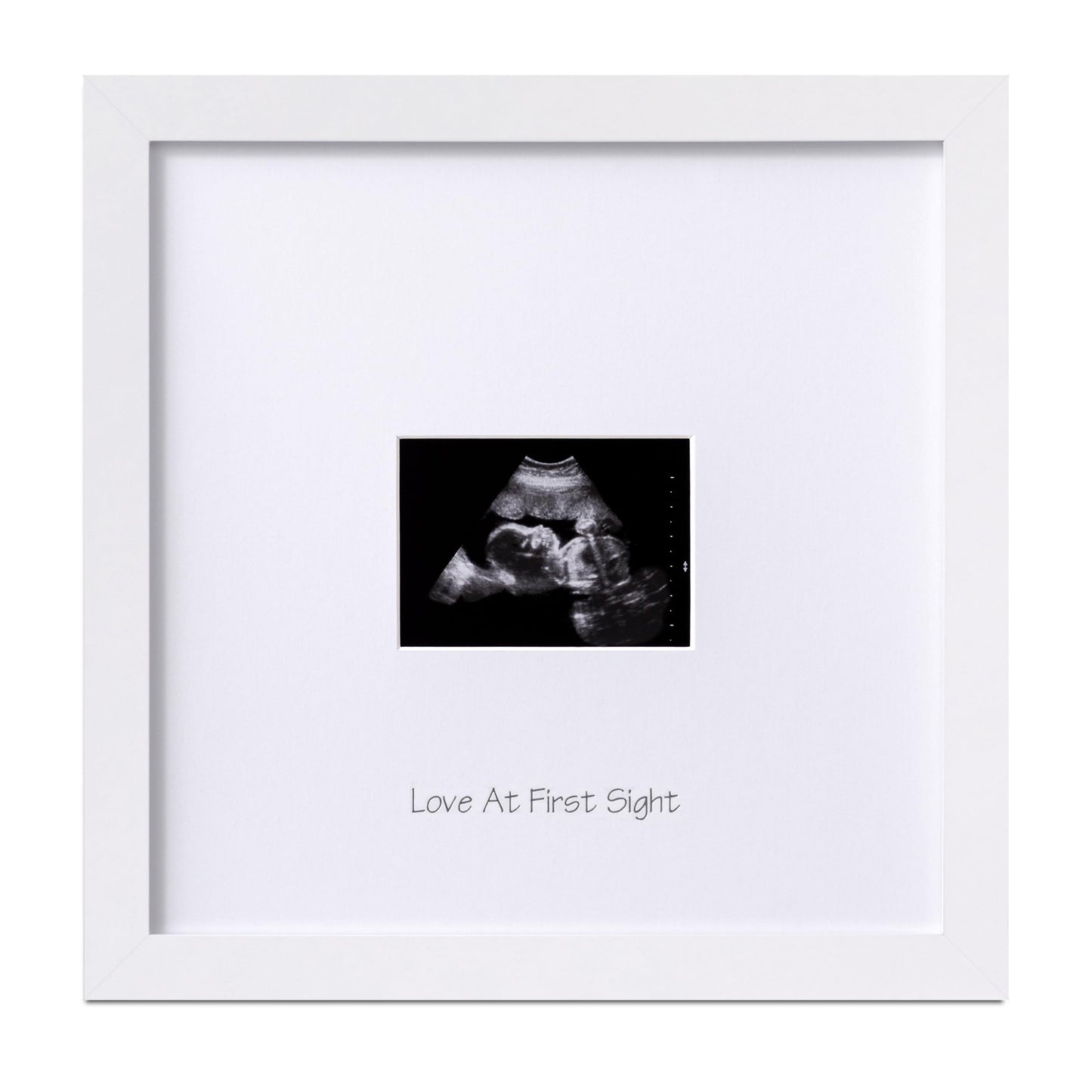 Eletecpro Baby Sonogram Picture Frame, Display 3  4 Ultrasound Photo, Keepsake Ultrasound Frame As A Idea Gift For Expecting Par