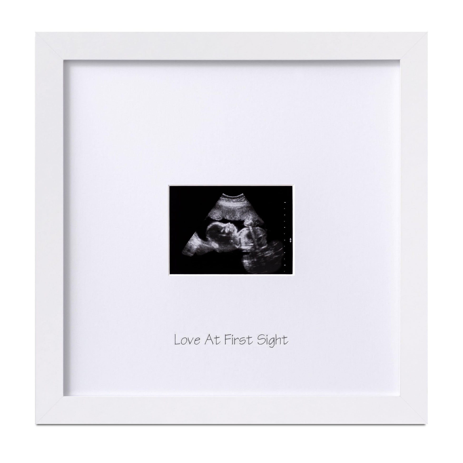 Eletecpro Baby Sonogram Picture Frame, Display 3  4 Ultrasound Photo, Keepsake Ultrasound Frame As A Idea Gift For Expecting Par