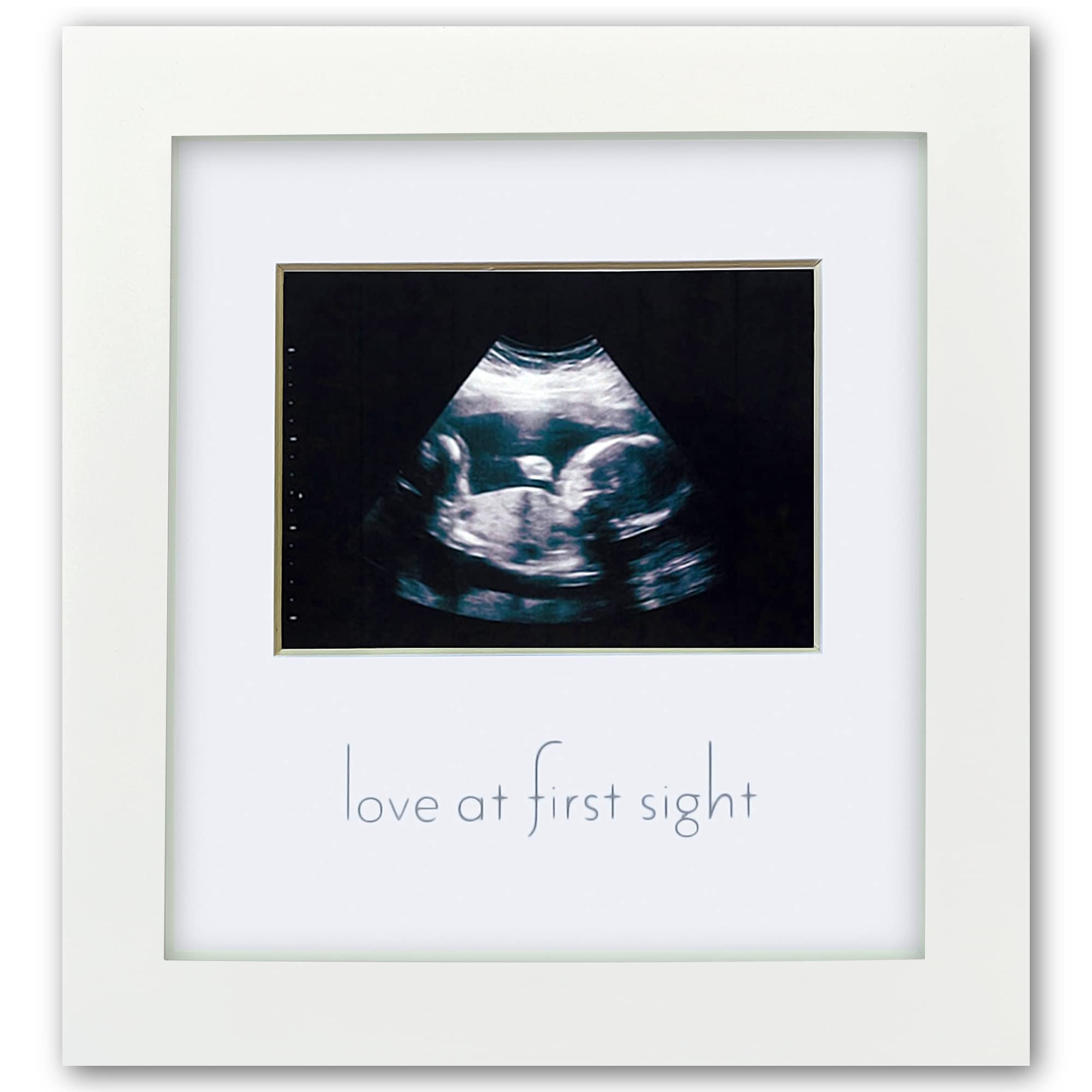 Green Pollywog Sonogram Photo Display | White Ultrasound Frame ...