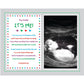 Poetry Gifts Hey Daddy It'S Me, Father To Be, Custom 8X10 Inch Personalized Print Add Ultrasound Photo