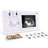 4  3 Baby Sonogram Picture Frame - Perfect for Pregnancy Ultrasound Photos, Pregnancy Announcement Gift for Expecting Parents, C