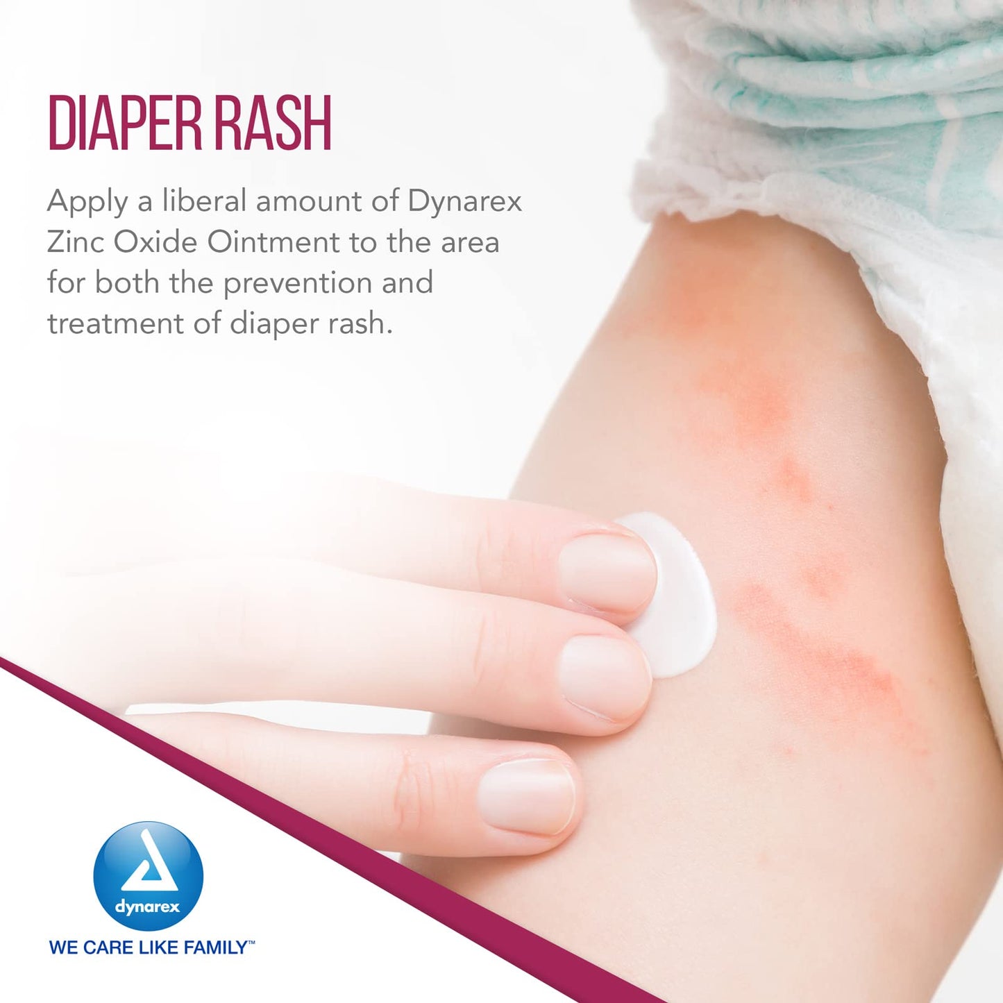 Dynarex Zinc Oxide Ointment, Soothes, Prevents, And Relieves Diaper Rash, Chaffed Skin, And Irritation, White, 1 Count - 15 Oz.