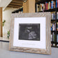 Iheipye Baby Love At First Sight Sonogram Keepsake Frame - Ultrasound Picture Frame - Pregnancy Announcement Frame For Expecting