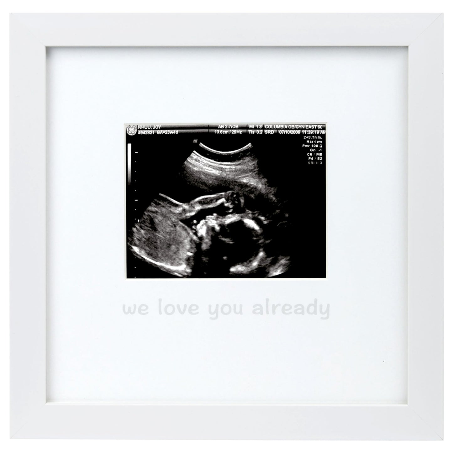 Tiny Ideas We Love You Already Sonogram Sentiment Frame, Baby Announcement, Gender Neutral Ultrasound Keepsake, Ideal Pregnancy