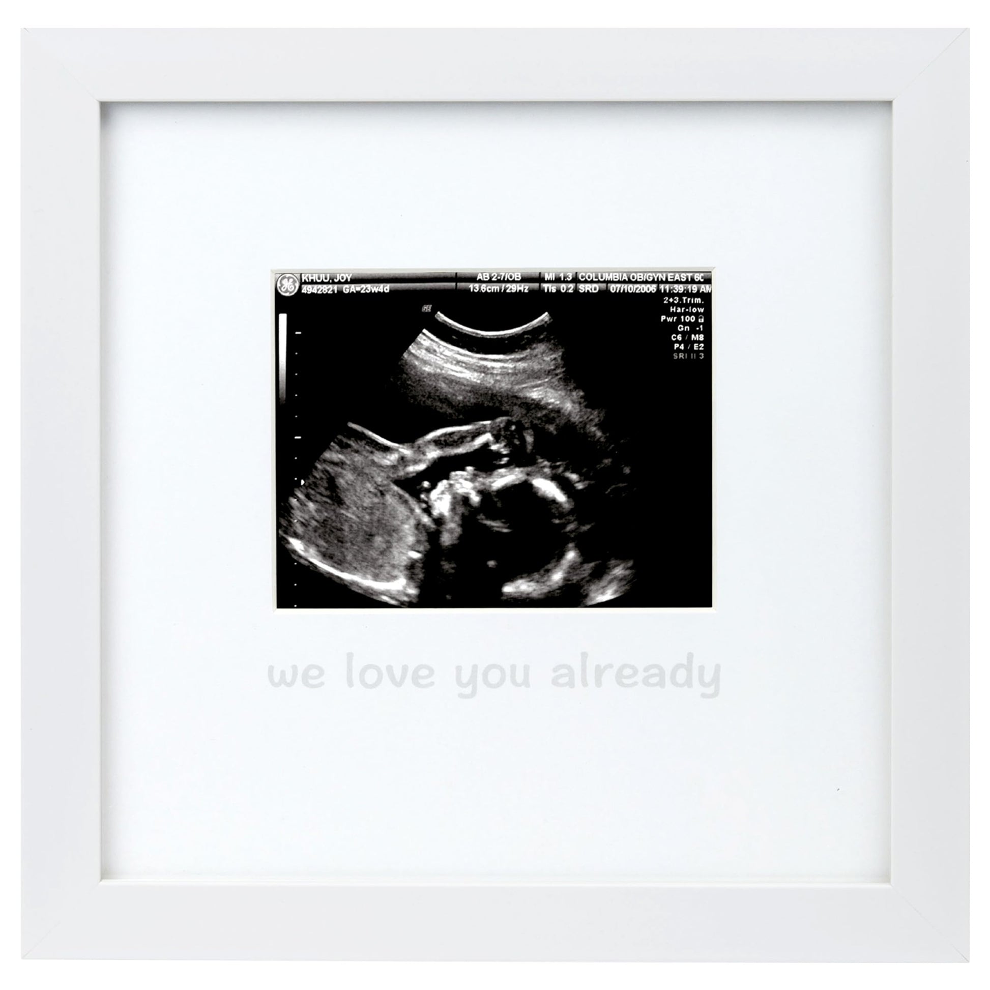 Tiny Ideas We Love You Already Sonogram Sentiment Frame, Baby Announcement, Gender Neutral Ultrasound Keepsake, Ideal Pregnancy