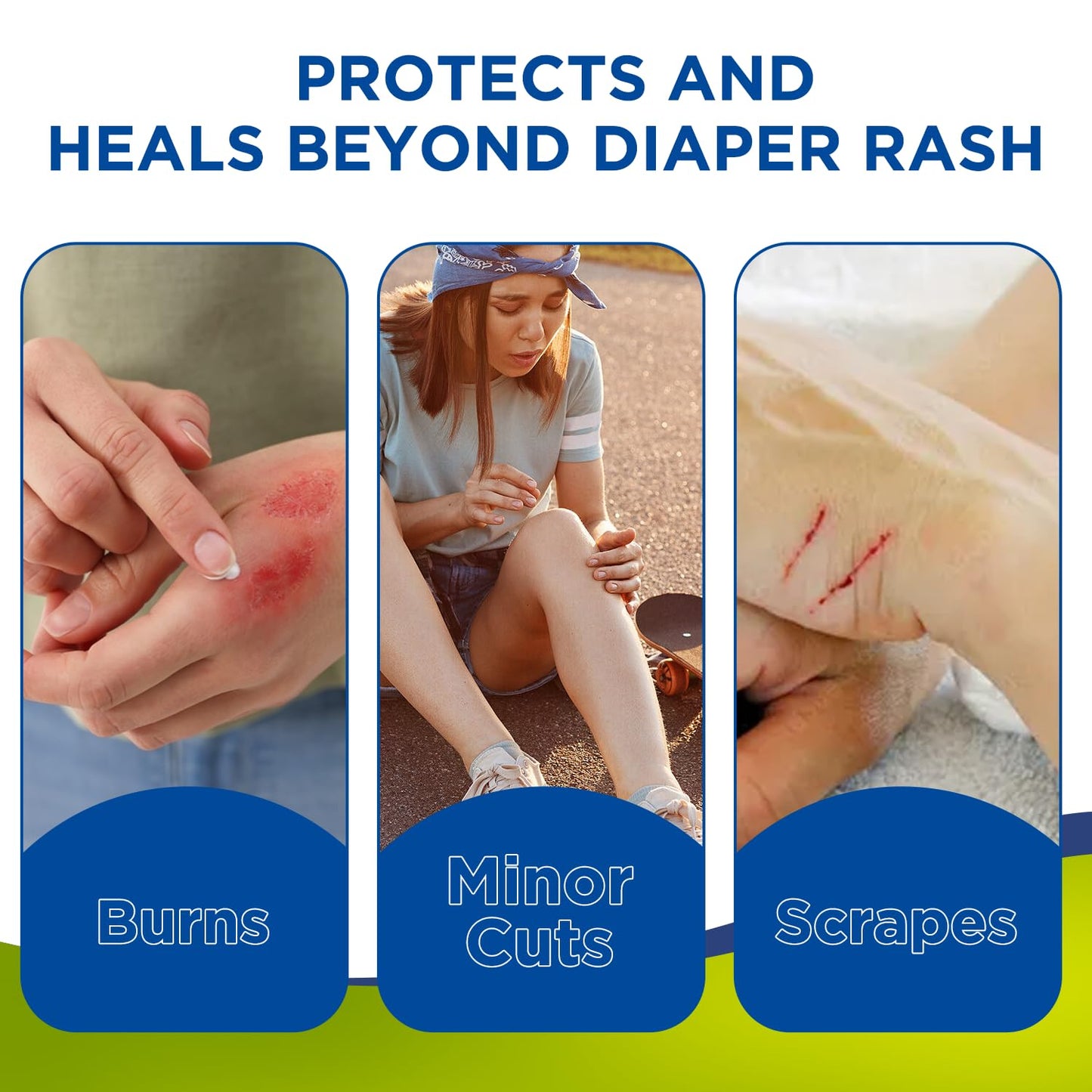 Nivagen Zinc Oxide Ointment Usp 20% | For Diaper Rash, Chafed Skin, Protects From Wetness, Relief From Poison Ivy, Poison Oak, &