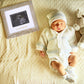 Iheipye Baby Love At First Sight Sonogram Keepsake Frame - Ultrasound Picture Frame - Pregnancy Announcement Frame For Expecting
