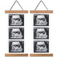 2 Pcs Sonogram Picture Frame, Wooden Magnetic Ultrasound Picture Frame For Refrigerator With Love At First Sight, For Baby Annou