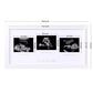 Eletecpro Triple Ultrasound Picture Frame, Display 3  4 Sonogram Photo, Keepsake Frame For Pregnancy Announcements, Expecting Pa