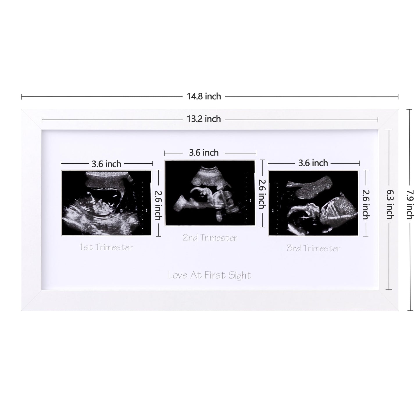 Eletecpro Triple Ultrasound Picture Frame, Display 3  4 Sonogram Photo, Keepsake Frame For Pregnancy Announcements, Expecting Pa