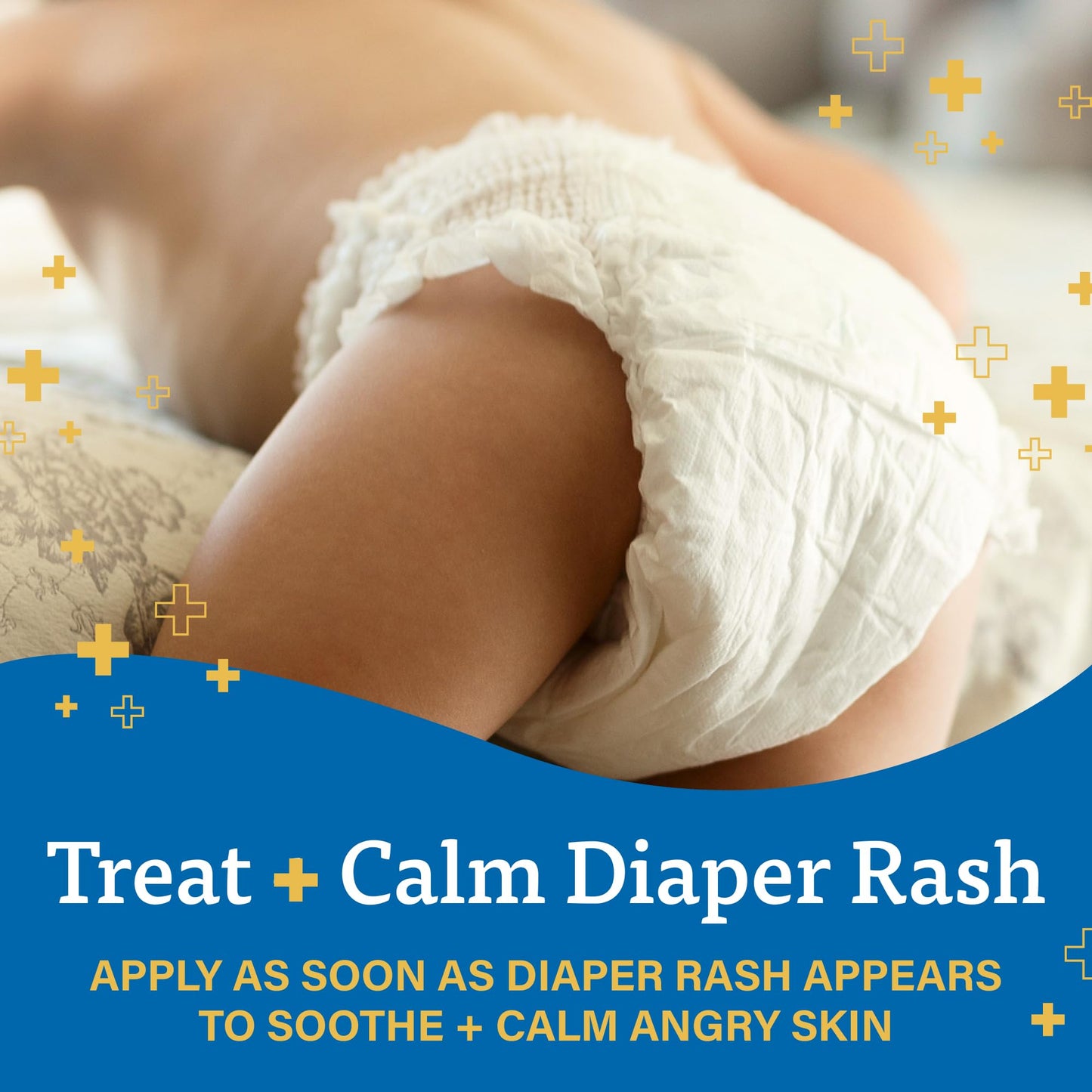 A+D Zinc Oxide Diaper Rash Cream - Soothes & Treats Diaper Rash - Zinc Oxide 10% Dimethicone 1% - Easy Spreading Cream For Baby