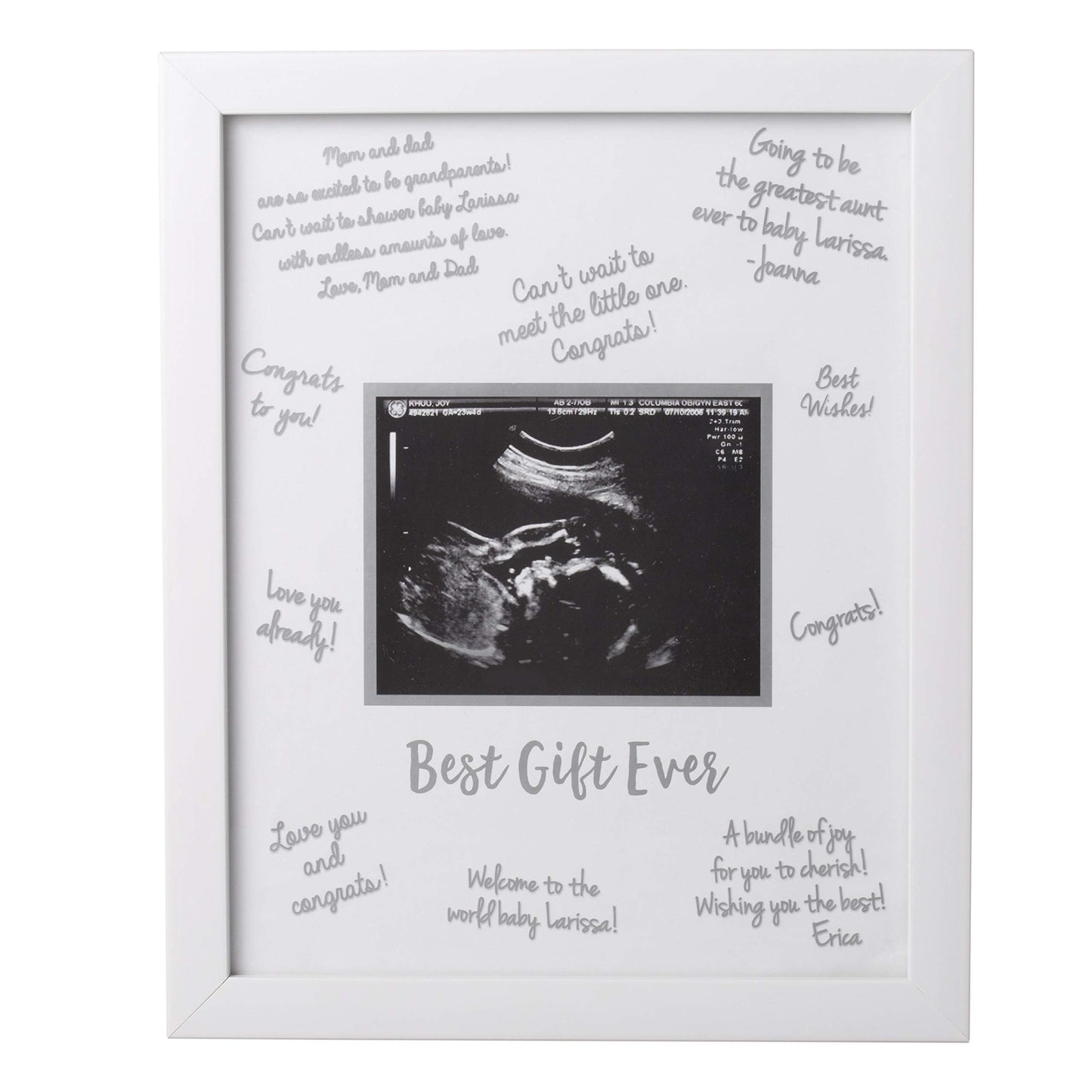 Tiny Ideas Sonogram Signature Frame Guest Book, Ultrasound Picture Keepsake, Gender Neutral Baby Shower Party Decor, Gift For Ex
