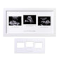 Eletecpro Triple Ultrasound Picture Frame, Display 3  4 Sonogram Photo, Keepsake Frame For Pregnancy Announcements, Expecting Pa