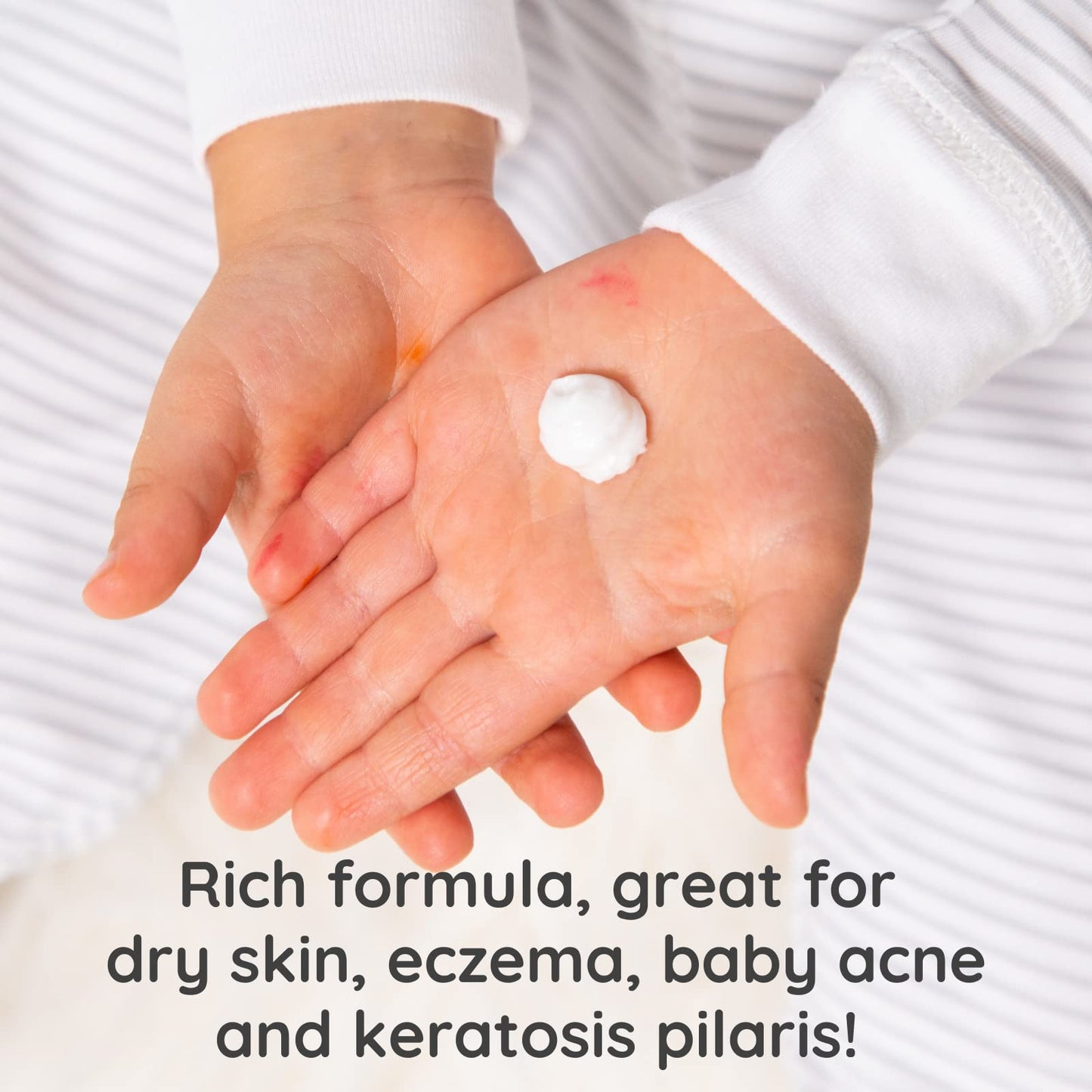 Bubbsi Whipped Coconut Oil Baby Lotion For Eczema, Dry Skin, Baby Acne, Kp | Organic Coconut Oil, Shea Butter, Vitamin E | Light
