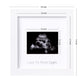 Eletecpro Ultrasound Picture Frame With Real Glass Cover And 3 Different Mats, 7X7 Baby Keepsake Frame For 3X4 Inches Sonogram P