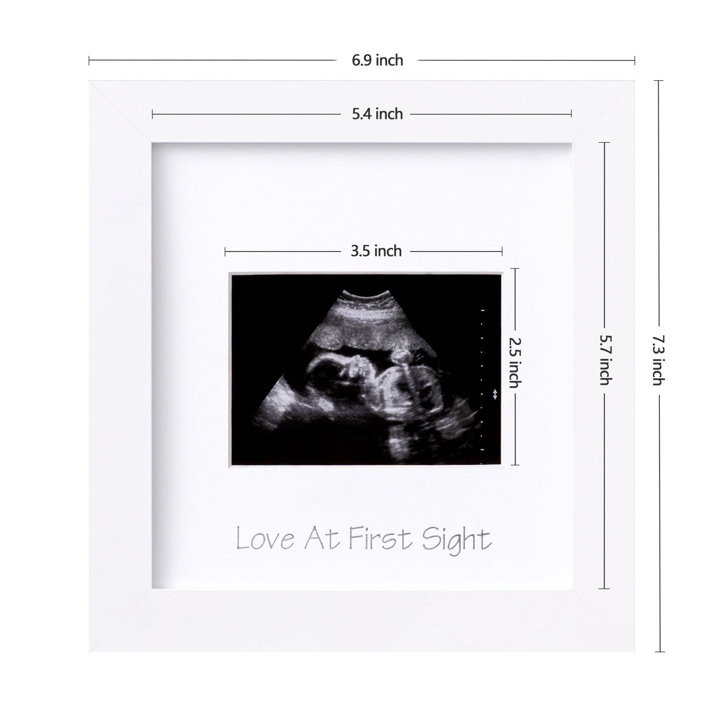 Eletecpro Ultrasound Picture Frame With Real Glass Cover And 3 Different Mats, 7X7 Baby Keepsake Frame For 3X4 Inches Sonogram P