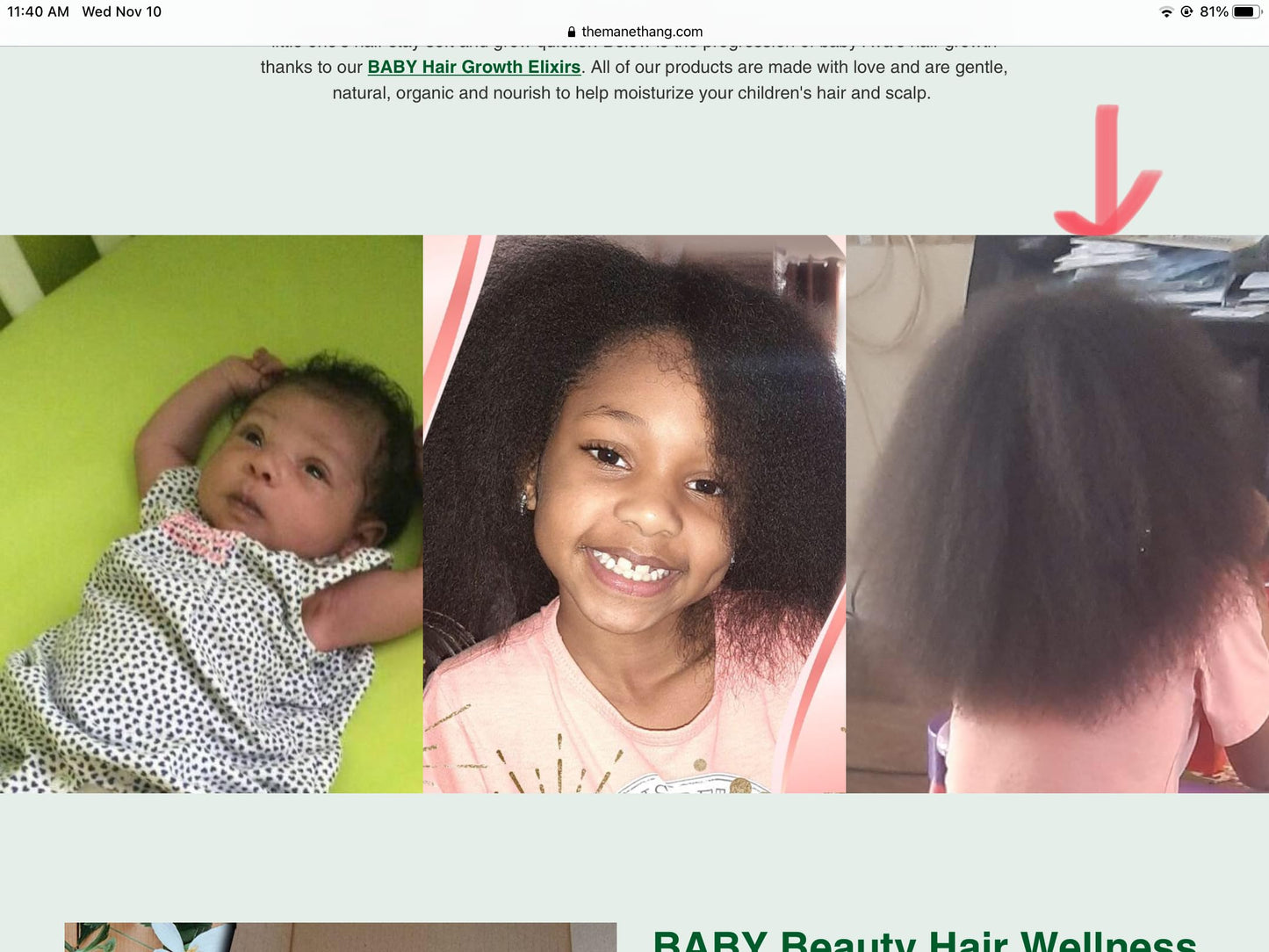 Themanethang Baby Hair Growth Oil - Organic Newborn Oil With Coconut, Olive, Castor, And Tea Tree Oils