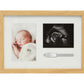 Kate & Milo Bracelet ID Photo and Sonogram Frame, Pregnancy Keepsake Frame, Wooden Newborn Baby Sentiment Frame