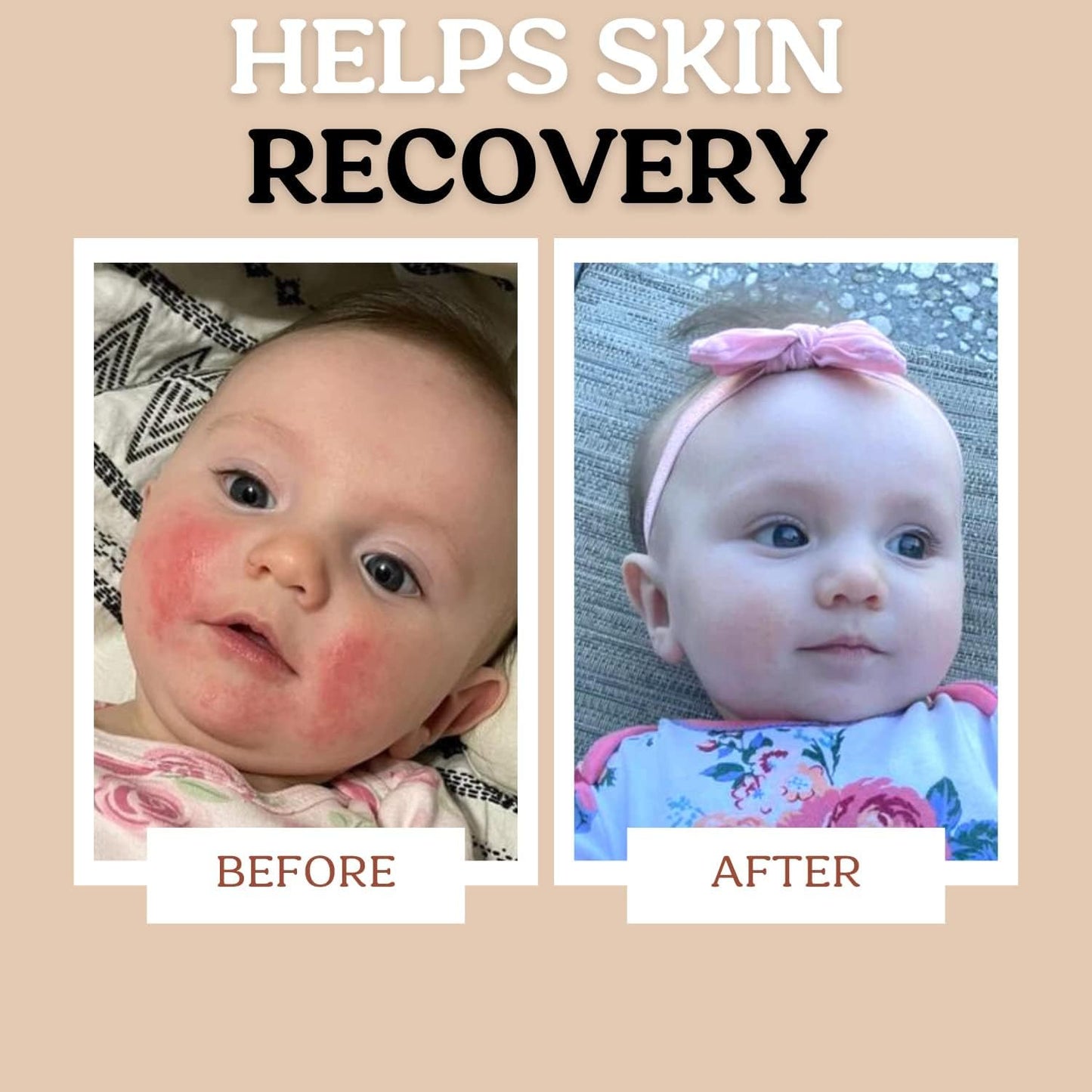 Roe Wellness Power Pair Probiotic Baby Power Serum & Biome Barrier Cream | Hydrating, Soothing, Clean Ingredients & Safe For All