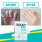 Nixxit Nail Biting Treatment For Kids - Stop Thumb Sucking For Kids, Toddlers, Children - No Bite Nail Polish Pen - Non Glossy -