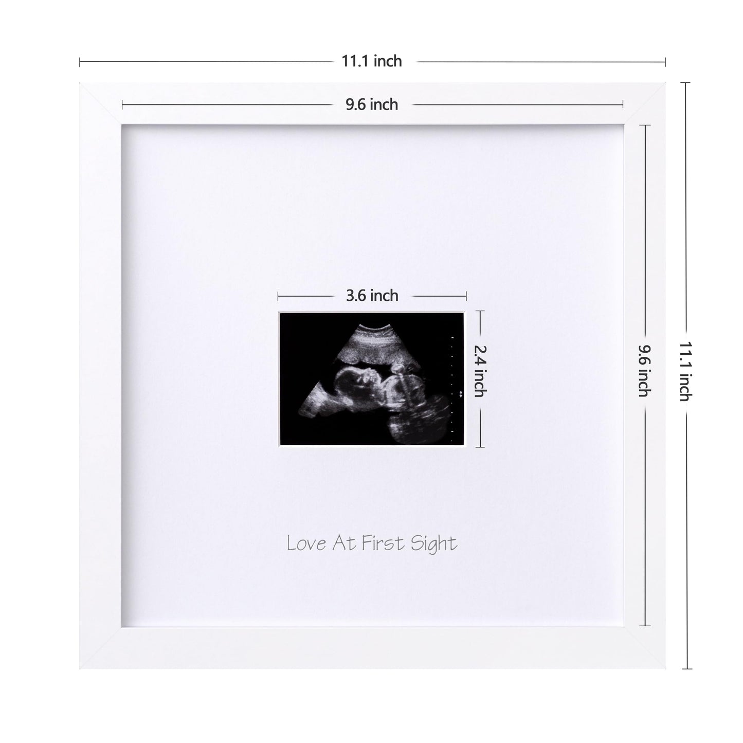 Eletecpro Baby Sonogram Picture Frame, Display 3  4 Ultrasound Photo, Keepsake Ultrasound Frame As A Idea Gift For Expecting Par