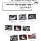 Iheipye Triple Sonogram Pregnancy Frame - Baby Ultrasound Picture Frame With Story For Expecting Parents, Baby Shower Frame, Bab
