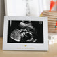 Pearhead Little Blossoms Love At First Sight Sonogram Picture Frame, Ultraound Pregnancy Keepsake, Gender-Neutral Nursery D  Cor